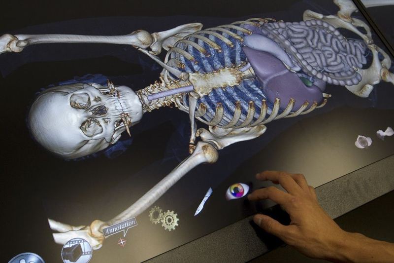 Diplomado Radiología Forense Aplicada a la Identificación Pericial